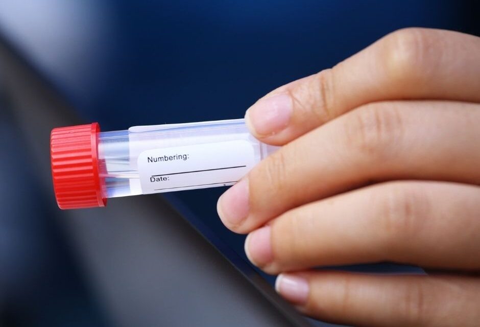 Gran acogida de los test de saliva gratuitos en las farmacias de Pontevedra